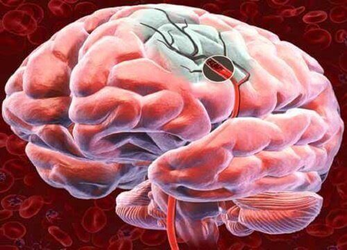 Kroppen pumpar mer blod till hjärnan-Så skyddar du hjärnan
